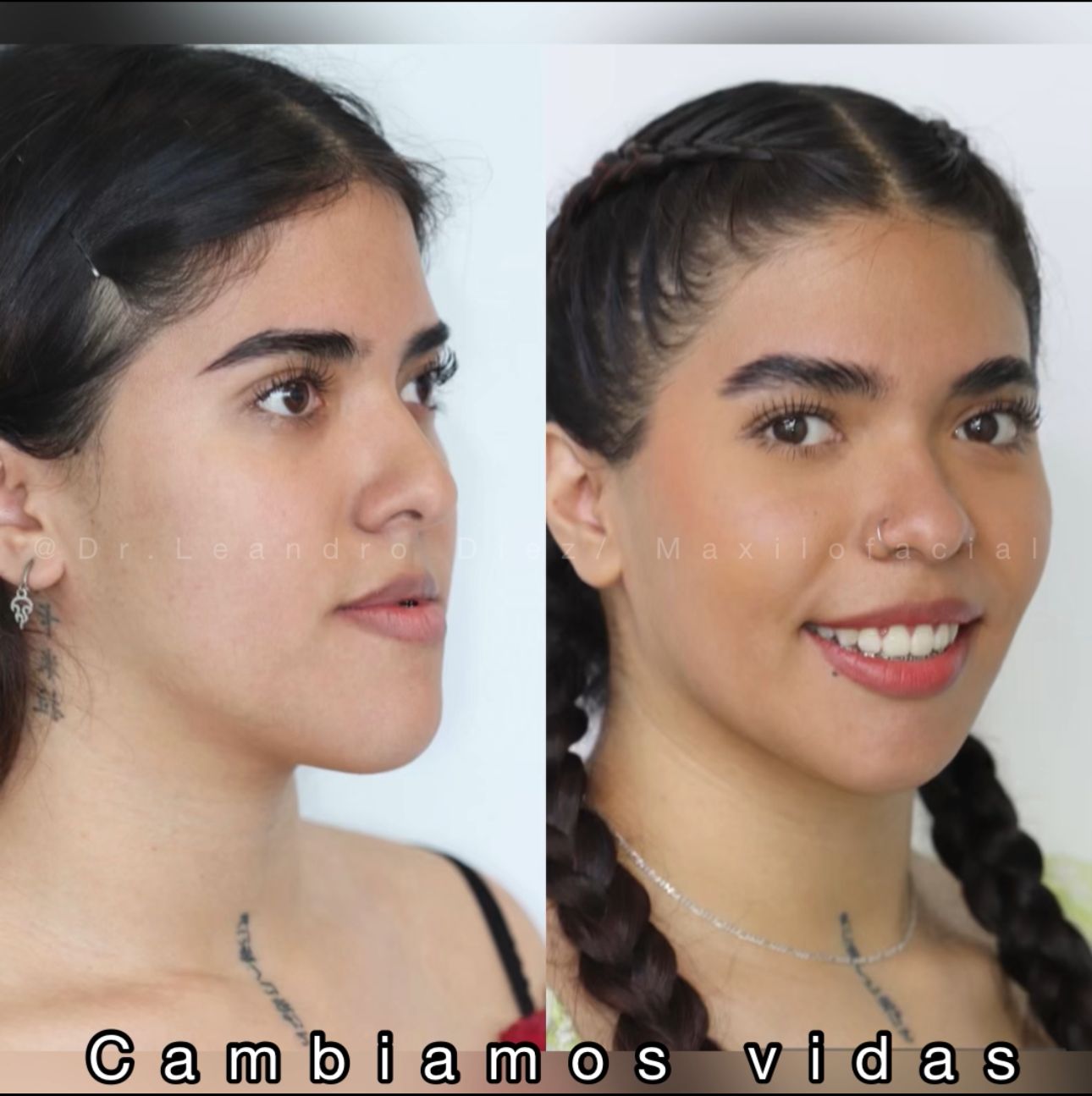 Foto profesional